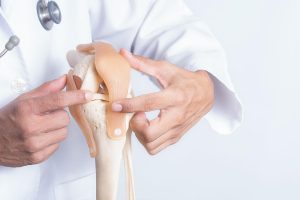 dokter spesialis orthopedi Ngawi