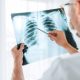 dokter spesialis paru Ngawi