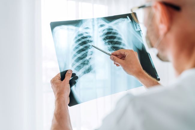 dokter spesialis paru Ngawi