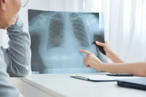 dokter spesialis paru Sumenep