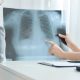 dokter spesialis paru Sumenep