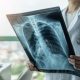 dokter spesialis paru Trenggalek