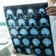 dokter spesialis saraf Probolinggo