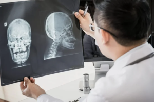 Praktek dr. Abdul Aziz, Sp. Rad, Dokter Spesialis Radiologi Sumenep