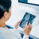 dokter spesialis saraf Lumajang