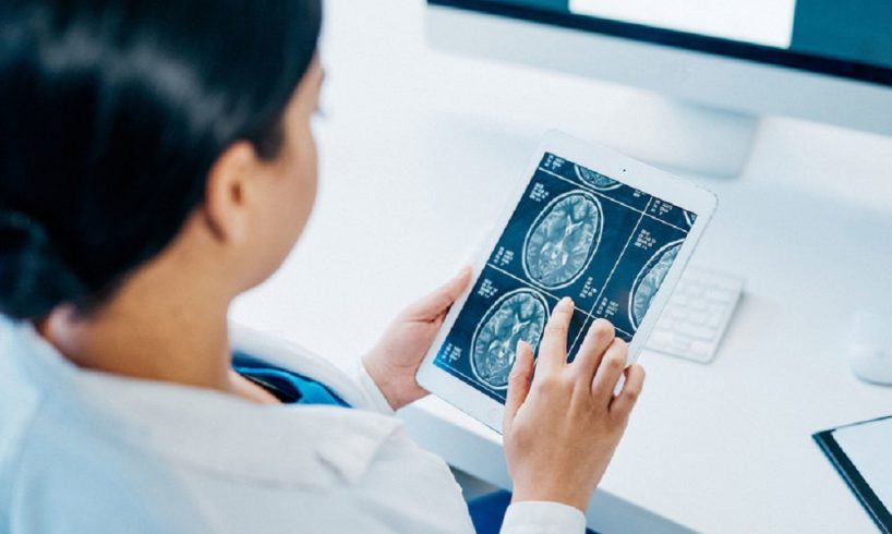 dokter spesialis saraf Lumajang