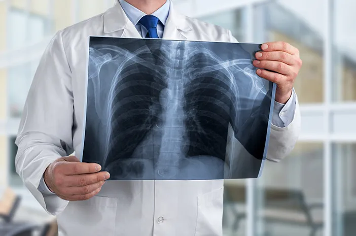 dokter spesialis radiologi Brebes dr. Baehaqi Sp. Rad