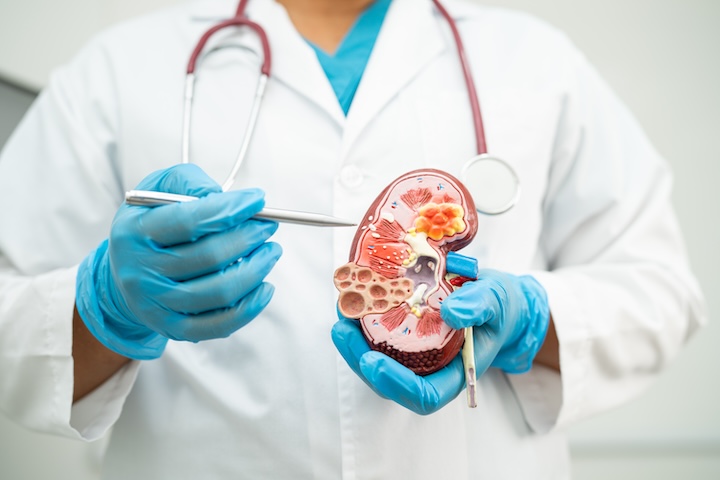 Praktek Dokter Spesialis Urologi Klaten, dr. Adhika, Sp. U