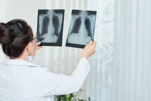 dokter spesialis paru Cilacap dr. Dwi Indrayati Sp. P