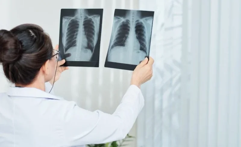 dokter spesialis paru Cilacap dr. Dwi Indrayati Sp. P