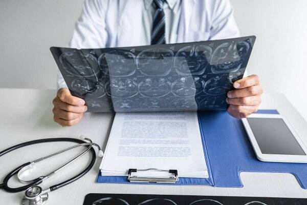 dokter spesialis saraf Banjarnegara dr. Eko Pudji Sp. S