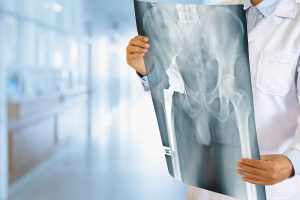 dr. Nata Baskara, Sp. OT, Dokter Spesialis Orthopedi Cilacap