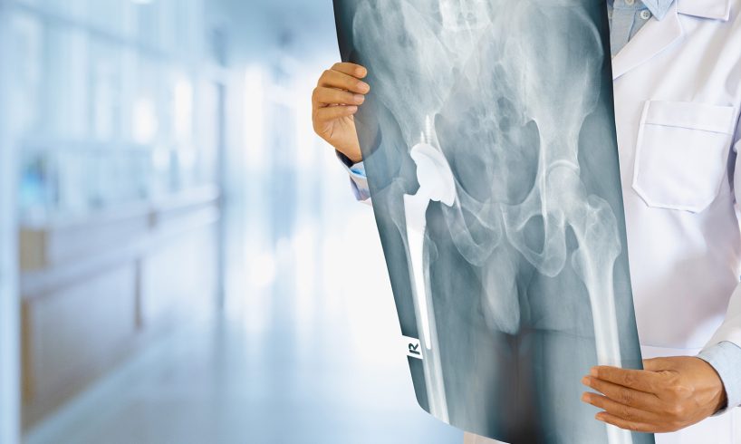 dr. Nata Baskara, Sp. OT, Dokter Spesialis Orthopedi Cilacap