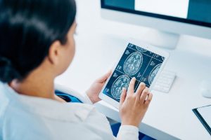 dr. Pipit Mei, Sp. N, Rekomendasi Dokter Spesialis Saraf Rembang