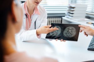 Rekomendasi Dokter Spesialis Saraf Salatiga, dr. Amelia, Sp. N