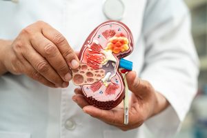 dr. Choirul Hadi, Sp. U, Dokter Spesialis Urologi Pekalongan