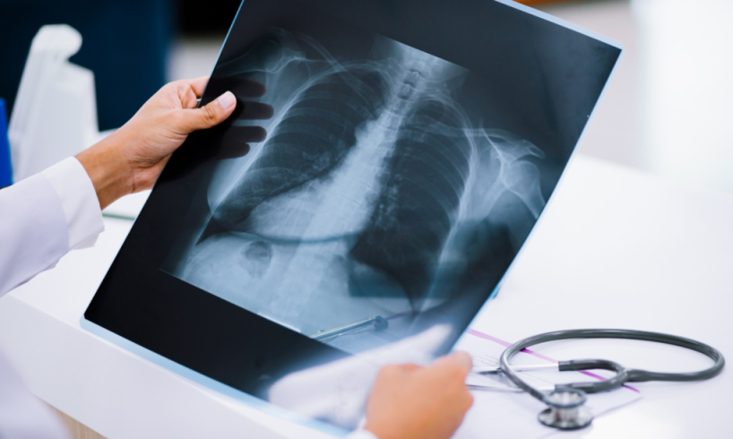 dr. Dwi Arifiany, Sp. Rad, Dokter Spesialis Radiologi Batang