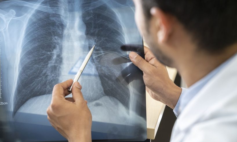 dokter spesialis paru Wonogiri dr. Bimo Sp. P