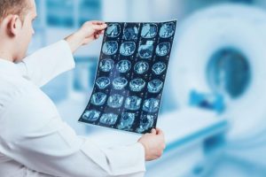 dr. Alip Asmadi, Sp. Rad, Dokter Spesialis Radiologi Tegal