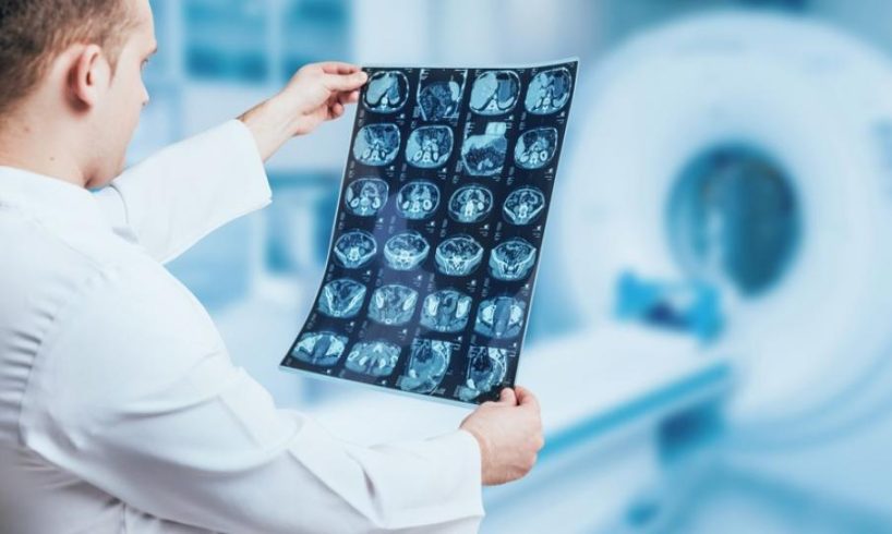 dr. Alip Asmadi, Sp. Rad, Dokter Spesialis Radiologi Tegal