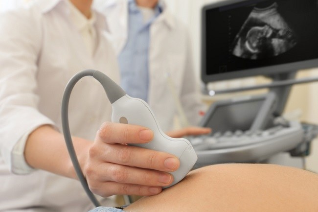 dr. Femi Suryanti, Sp.OG, Dokter Spesialis Kandungan Barito Kuala