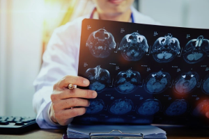 Dokter Spesialis Saraf Hulu Sungai Tengah, dr. Gilang, Sp.N