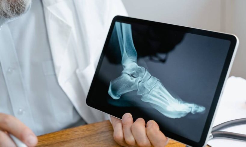 Praktek Dokter Spesialis Orthopedi Tapin, dr. Bagus, Sp.OT