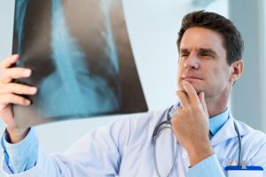 dokter spesialis paru Hulu Sungai Utara dr. Yusuf Sp. P