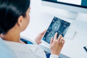 dr. Rizki Novrildawati, Sp.N, Praktek Dokter Spesialis Saraf Tapin