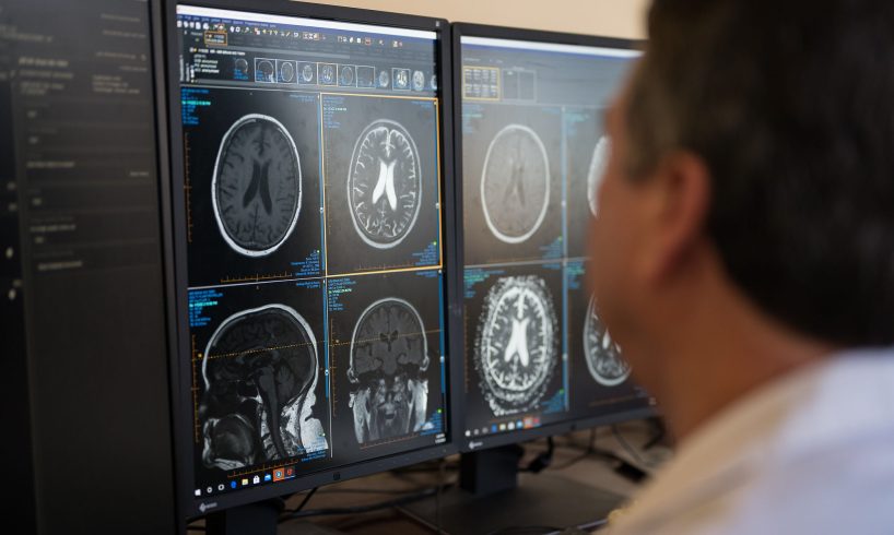 dokter spesialis radiologi Hulu Sungai Tengah dr. Harkani Sp. Rad