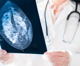 dokter spesialis radiologi Yogyakarta dr. Dewi