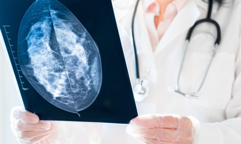 dokter spesialis radiologi Yogyakarta dr. Dewi