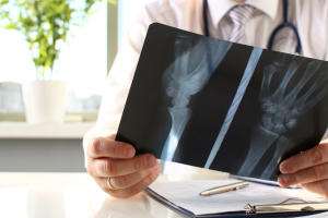 dokter spesialis ortopedi Kulon Progo dr. Bayu