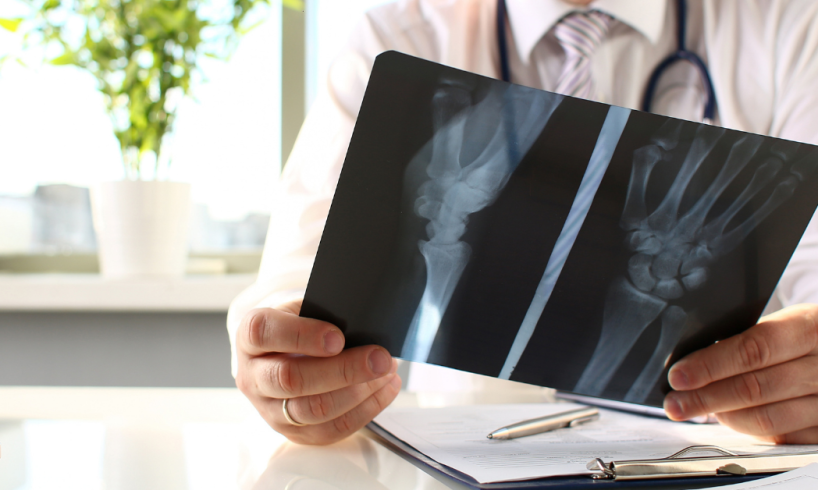 dokter spesialis ortopedi Kulon Progo dr. Bayu